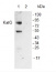KatG | catalase peroxidase (HPI), cyanobacterial 